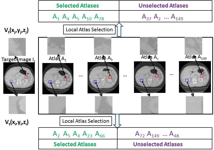 Figure 1: Demonstration of the voxel-wise local atlas selection strategy. At different locations in the target image I t, different subsets of atlases are selected.
