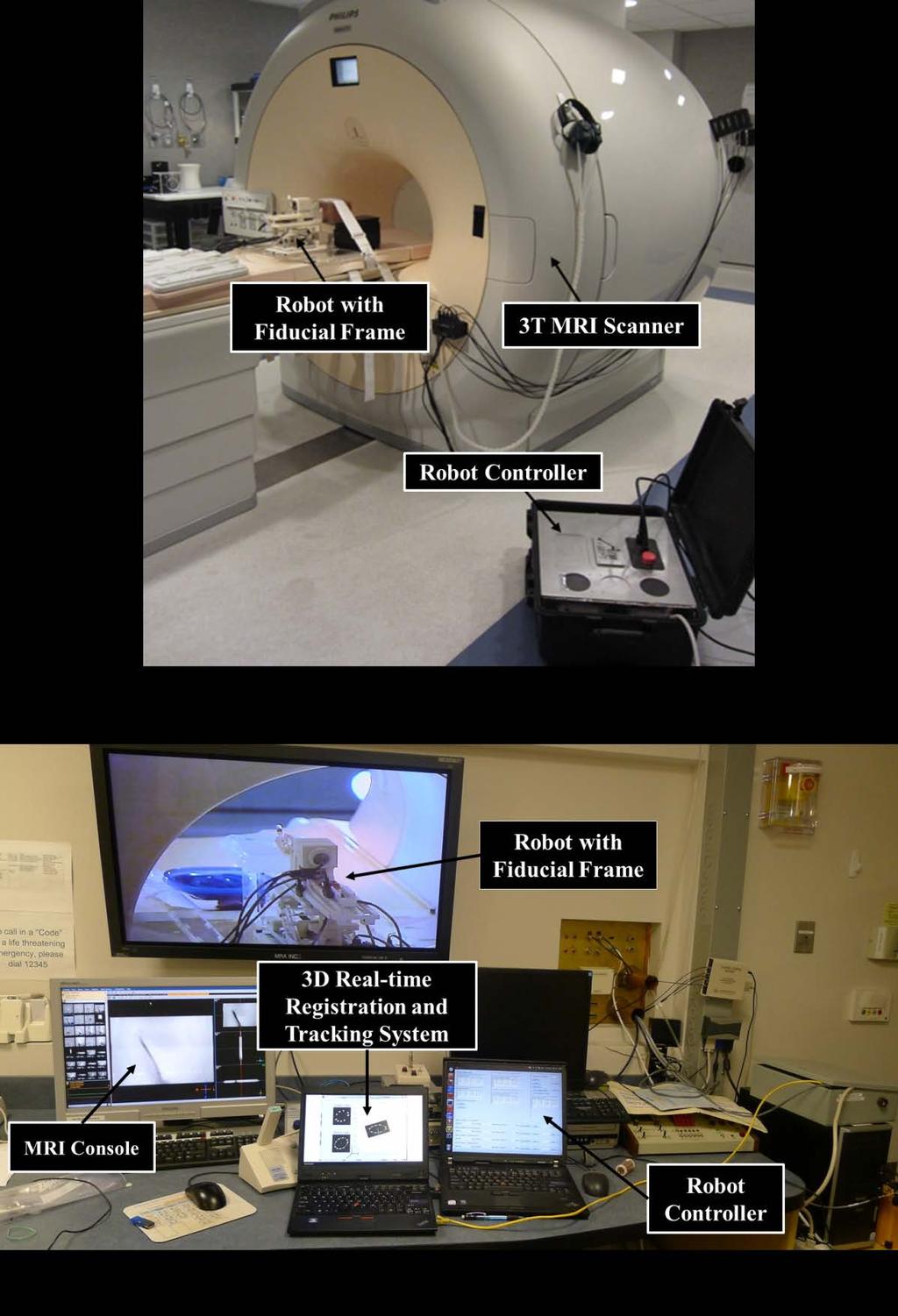Fig. 3-2: The panorama of real-time MRI-guided robotic surgery system
