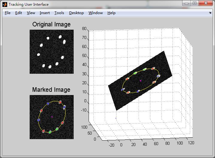 3.4 1User Interface Module The user interface module running on Matlab platform provides an intuitive sense for tracking surgical procedure in real time.
