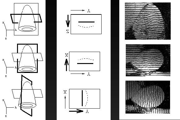 Image Acquisition for 3D Motion Information Tag plane (dark) and image plane orientation Possible tag motion in image plane Representative images 3D Motion Reconstruction Most techniques have been