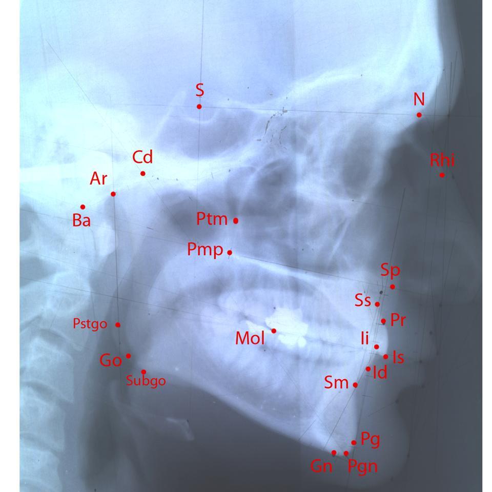 Figure 1: Example of X-ray with 22 landmarks (right lateral view; landmark definitions see in Velemínská et al.