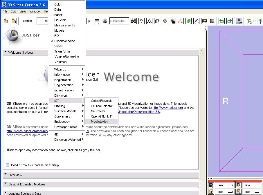 Start the ProstateNav module When 3D Slicer is started it shows the Welcome window on the left.