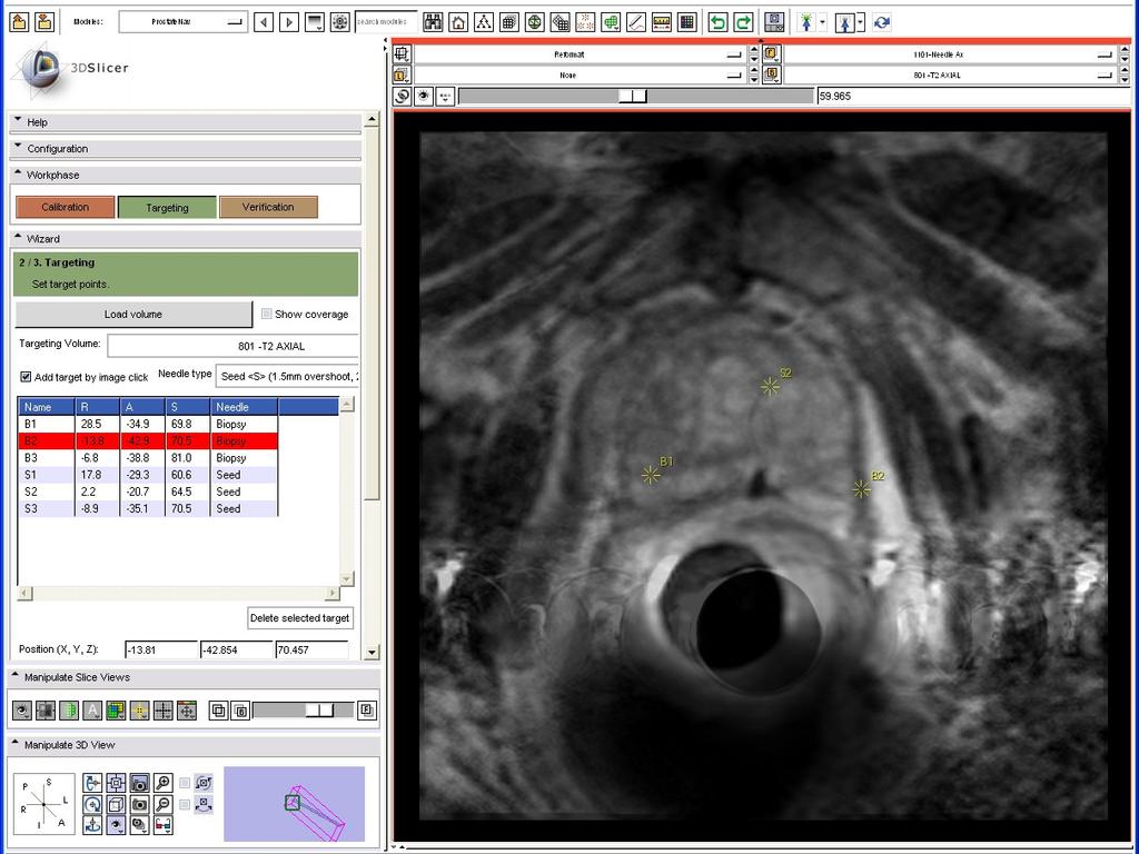 Evaluate patient motion 1 Click on Targeting 2 Re-select the targeting image to show it in the slice viewers 3 Select the Red slice only layout to see a maximized view of the axial slice