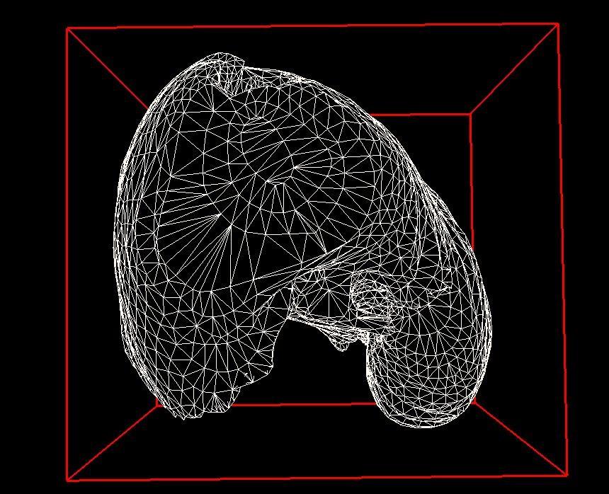Triangulated 3D model of dog liver Vertices in one contour need to be matched with those in the next slice to