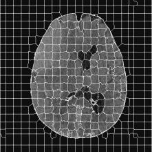 4 SOLTANINEJAD ET AL.: HAEMORHAGE SEGMENTATION IN BRAIN CT superpixel grouping is shown in Figure 2.