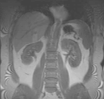 2.5f: MRI Scan of Body (Liver