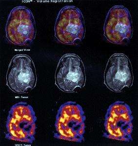 2.6i: PET and MRI Images