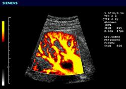 2.6e: Ultrasound Image of