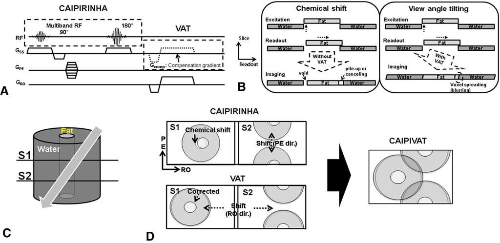Figure 1. Pulse sequence diagram of CAIPIRINHA using view angle tilting technique (CAIPIVAT) (A) and illustrations of the principle of view angle tilting (VAT) (B).