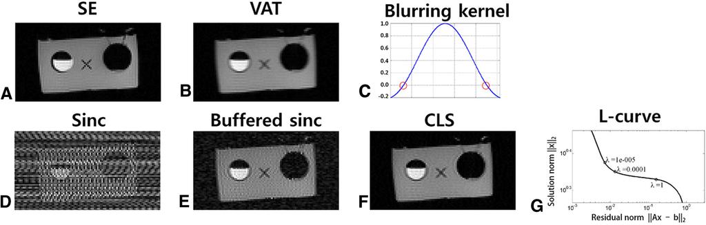 Figure 2. VAT blurring and its compensation. Reference SE image (A). Acquired VAT image (B). Blurring kernel (sinc function) and its zero crossing (red circle) (C).