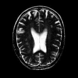 To validate the fused image both subjectively and objectively. Input Image The brain image with lesion is used for fusion.