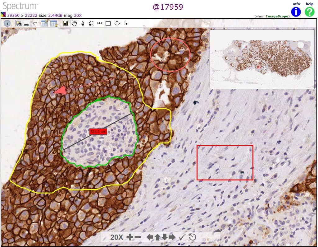 WebScope Annotations Annotation Drawing Tools Annotations can define a region of interest and measure an object on the digital slide. To use a tool, select tool, left-click and move across the image.