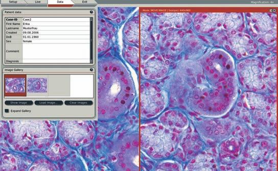 Fast measurements The Leica DMD108 allows you to quantify varying structure sizes in a specimen. Distances and areas are measured easily and accurately with just a click of the mouse.