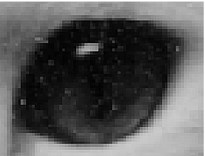 B) Detail of area around one eye showing individual pixels.