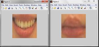 Example of the smile image [16] Fig.2.