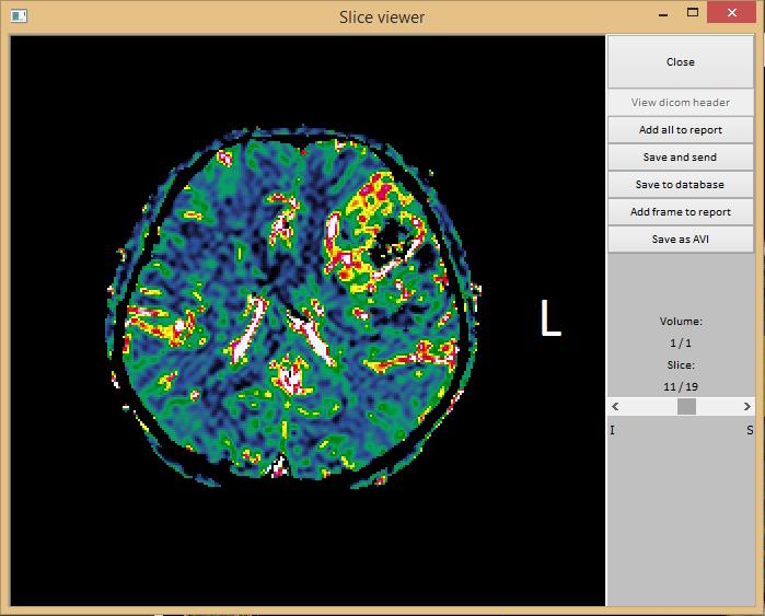 Figure 14: The slice viewer. View dicom header: available once the derived series is saved to the local database. Send Send the dataset to a remote DICOM node, like e.g. a PACS system.