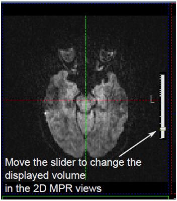 This option gives you a pop-window with the results from the motion correction and/or eddy current correction graphically displayed.