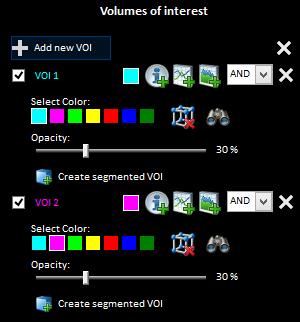 For each VOI you have a set of icons/options to interact with that specific VOI: Visibility checkbox for the VOI If checked the VOI is visible in the 2D MPR views and in the 3D viewer.
