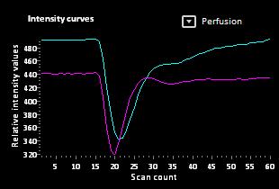 Whenever the VOI is moved/scaled/resized the curve will be updated to reflect the signal curve in the current VOI. 3.6.