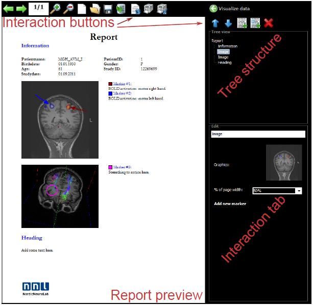 4 Report 4.1 Global report functions The nordicbrainex report module provides tools for generating a report based on the analysis results.