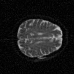 Fusing Multiple Representations 11 measurements, and that the randomized IHTs can improve on the standard IHTs performance. We start with the MRI scan of a human brain shown in Figure 1.