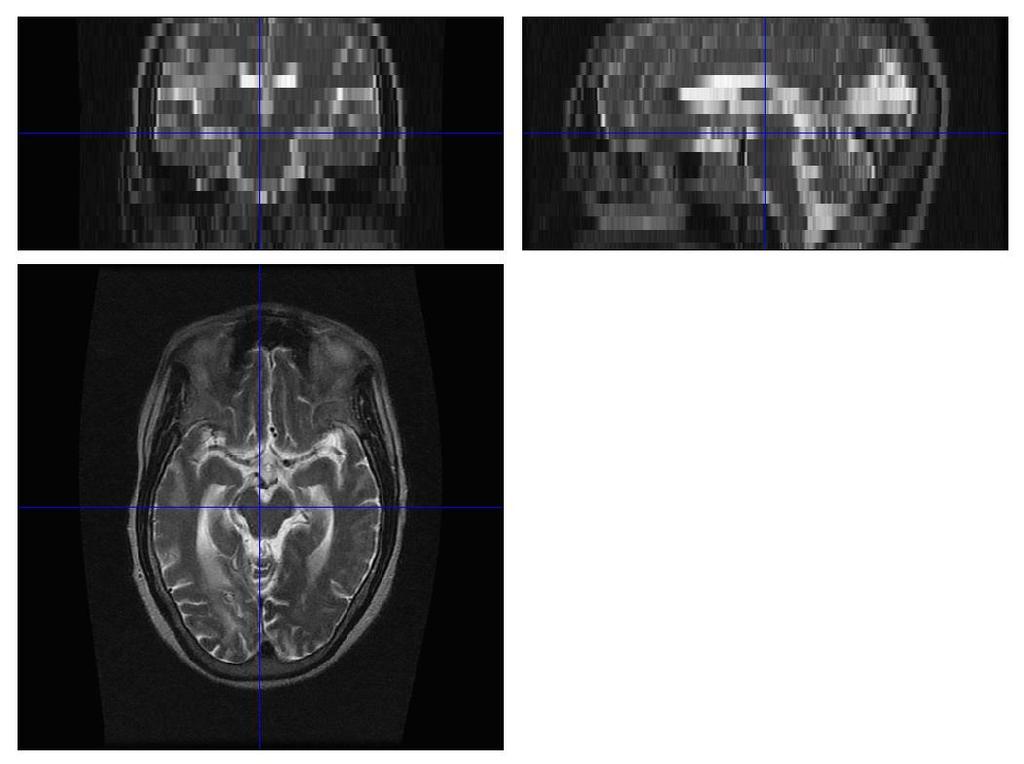 Same subject, different MRI contrasts, different image