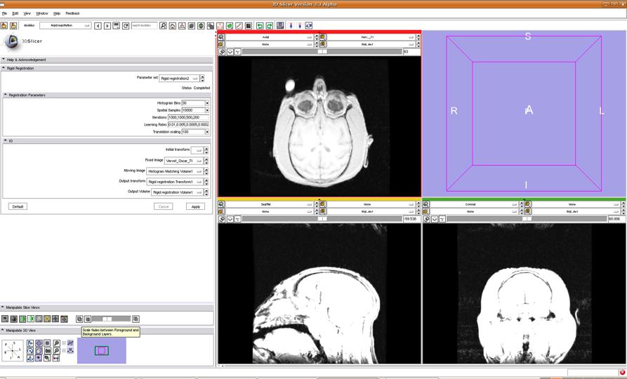 Subject Image Skull Stripping Rigid Registration In order to check registration accuracy, choose the fixed image as foreground and the output image as background Now