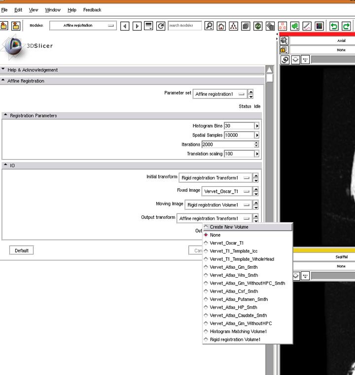 Subject Image Skull Stripping Affine Registration Create a new volume for the output image Click