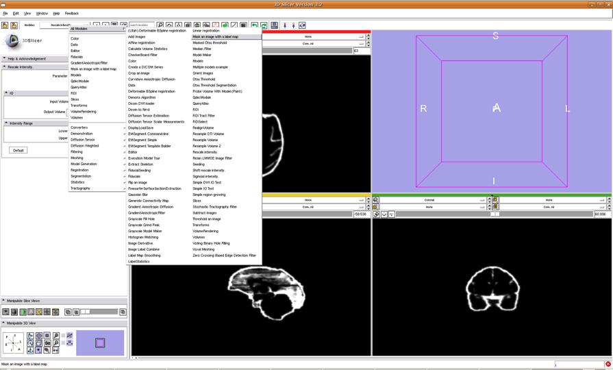 Subject Image Skull Stripping Mask Subject Image with ECC Mask Once the MaskImage utility has been