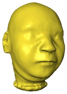 Shape class of abnormal heads (-1) 3-D Range Scene Single