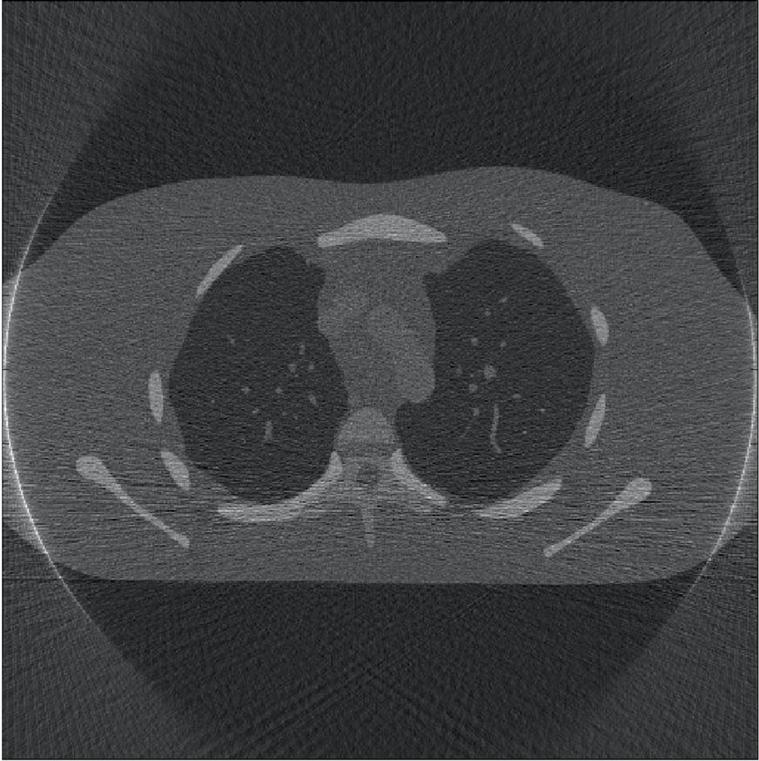 Figure 3: Example reconstructed CT