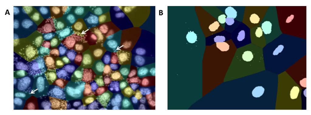 LAB: CHALLENGE Count the number of infected cells by assigning (eg Voronoi) parasites to BeWo