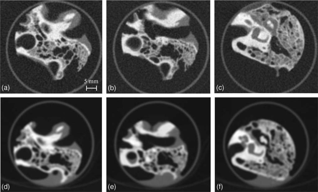 1876 Schmidt et al.: A prototype table-top inverse-geometry CT system 1876 FIG. 8. Axial images of an inner ear specimen acquired by a c the IGCT system and d f a 16-slice scanner.