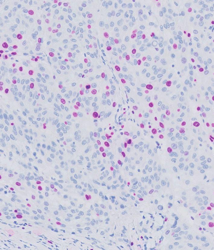 HRP Magenta offers: Clear distinct staining High contrast, vibrant color Visible details Figure 1.