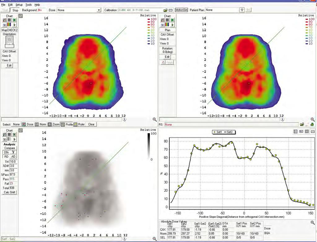 Software With a single mouse click, SNC Patient software compares measured dose points to planned dose points.