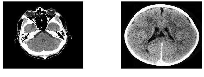 3202 Medical Image Fusion Here MRI and CT images are fused. Fig.4.