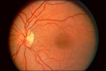 Biometrics: Retina Feature extraction from the bottom eye s circulatory structures