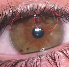 The detected eyelashes from the eye image can be isolated from the inside region of iris circle.