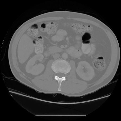 3 CT Slices of the Abdomen