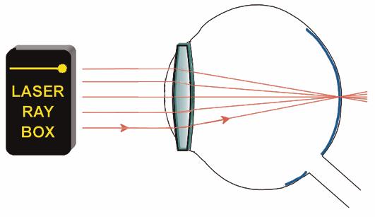 V 1 H H' V 2 f' F' E22a Model of a normal eye (RODS, Working sheet ) retina Display rays parallel to the optical axis intersect after passing