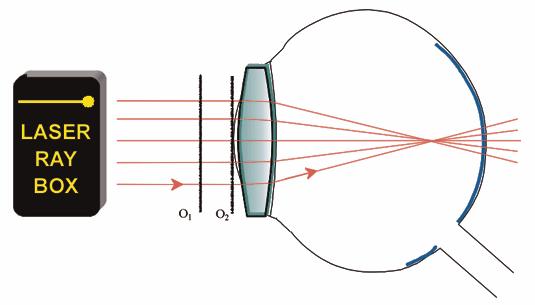 (1) V S eye lens E22b Model of short-sighted eye (RODS, Working sheet ) eye lens retina Display rays parallel to the optical axis intersect after