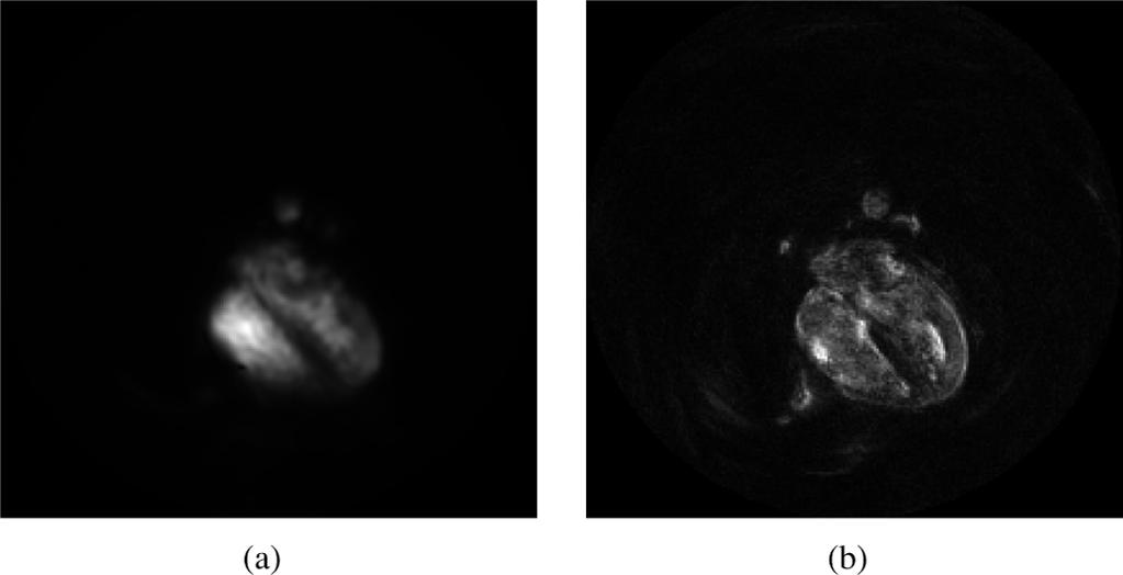 (a) High temporal resolution, low spatial resolution map obtained by a separate training scan. (b) Low temporal resolution, high spatial resolution map obtained from within the data.