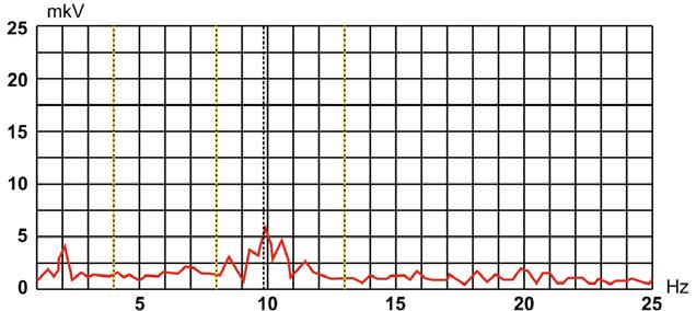 Fig. 3 EEG spectral density in the Pz lead (10x20 scheme) in a relatively healthy subject.