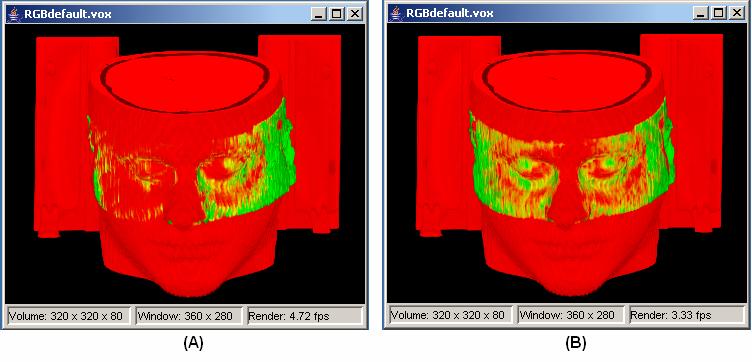 3D Voxel-Based Volumetric Image Registration with Volume-View Guidance 5 in the literature.