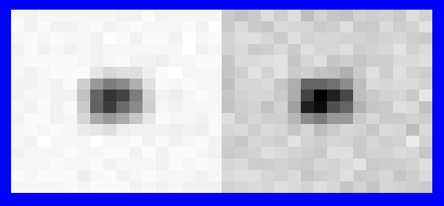 (Citrate Image) Four acquisitions: Half pixel shifts in two directions, reconstructed and combined using super-resolution algorithm.