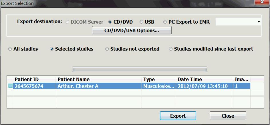Exporting Studies Exporting Studies You can export studies, imagesto to a CD, a DVD, a DICOM server, a USB drive, or another location on a network.