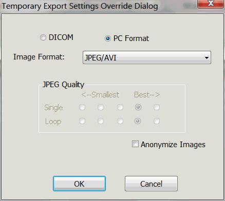 To change the JPEG quality, select a radio button in the JPEG Quality area. e. To copy a DICOM image viewer onto the CD, select Include viewer on CD/DVD so the box is checked.