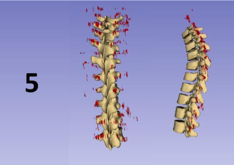 The reparation operations described above are able to correct the initial estimation to reveal the underlying structure and curvature of the spine from each of the subjects.