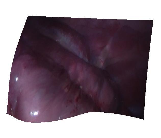 organs are shown in Figure 5, which shows that the recovered 3D models are accurate.