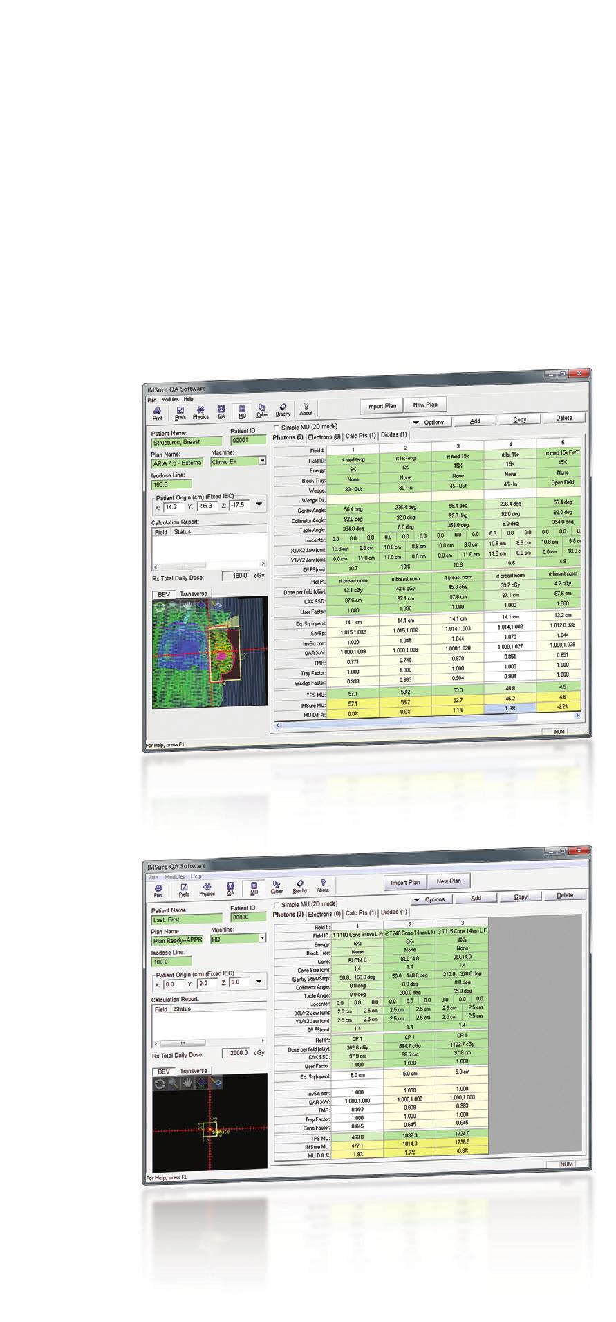 Easy Monitor Unit Verification Non-IMRT plans for both photon and electron beams are easy to verify in IMSure QA. The information you need to verify your plan is shown on a single screen.